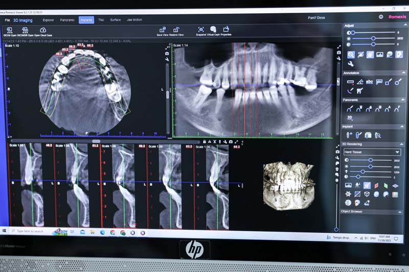 Stomatološka protetika